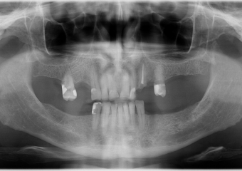 Rx Inicial  - Clínica Cliniface