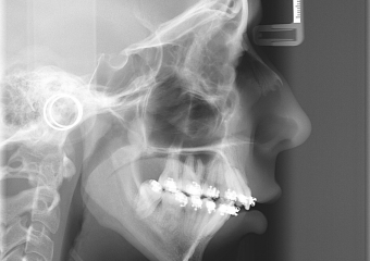 Telerradiografia inicial - Clínica Cliniface