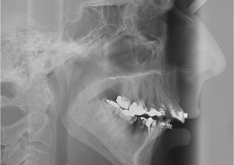 Telerradiografia inicial - Clínica Cliniface