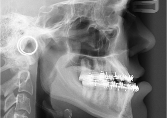 Telerradiografia inicial - Clínica Cliniface