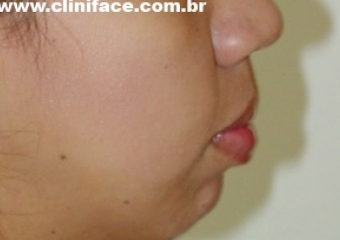 Imagem perfil inicial - Clínica Cliniface