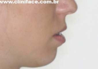 Imagem perfil inicial     - Clínica Cliniface