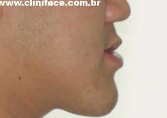 Imagem perfil inicial - Clínica Cliniface