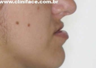 Imagem perfil inicial  - Clínica Cliniface