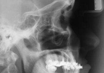 Telerradiografia inicial - Clínica Cliniface