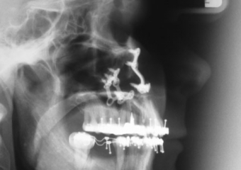 Telerradiografia final - Clínica Cliniface