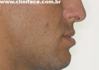 Perfil inicial - Clínica Cliniface