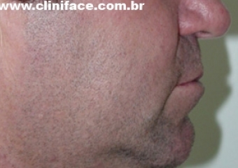 Perfil final - Clínica Cliniface