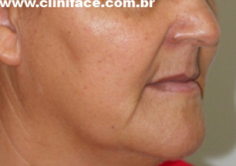 Imagem perfil inicial - Clínica Cliniface