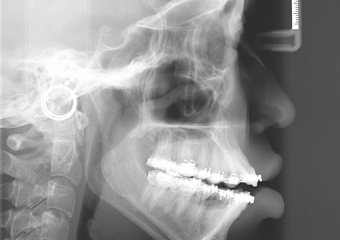 Telerradiografia Inicial - Clínica Cliniface