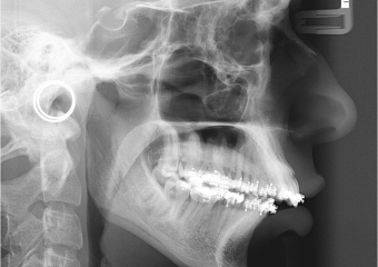 Telerradiografia inicial - Clínica Cliniface