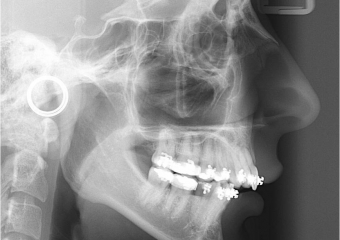 Telerradiografia inicial - Clínica Cliniface