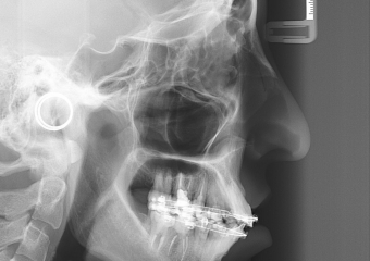 Telerradiografia inicial - Clínica Cliniface